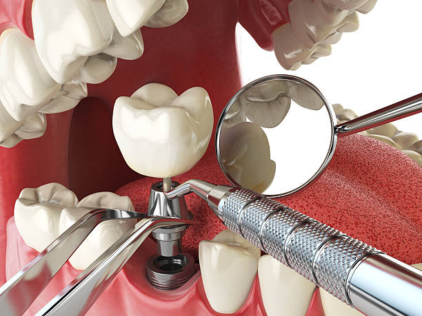 Best Emergency Broken Tooth Repair in Rawlins, WY